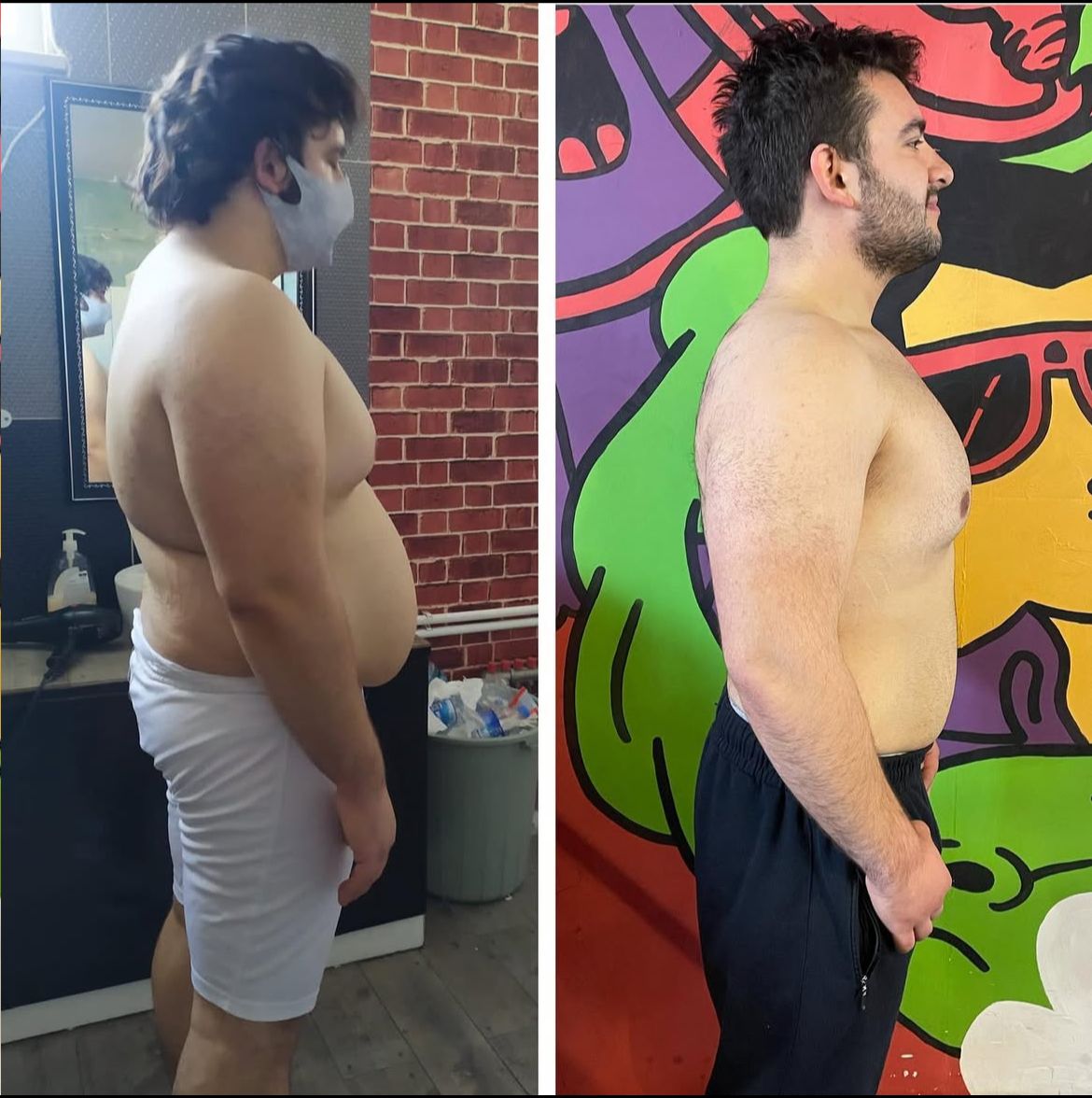 Before After Transformation 9